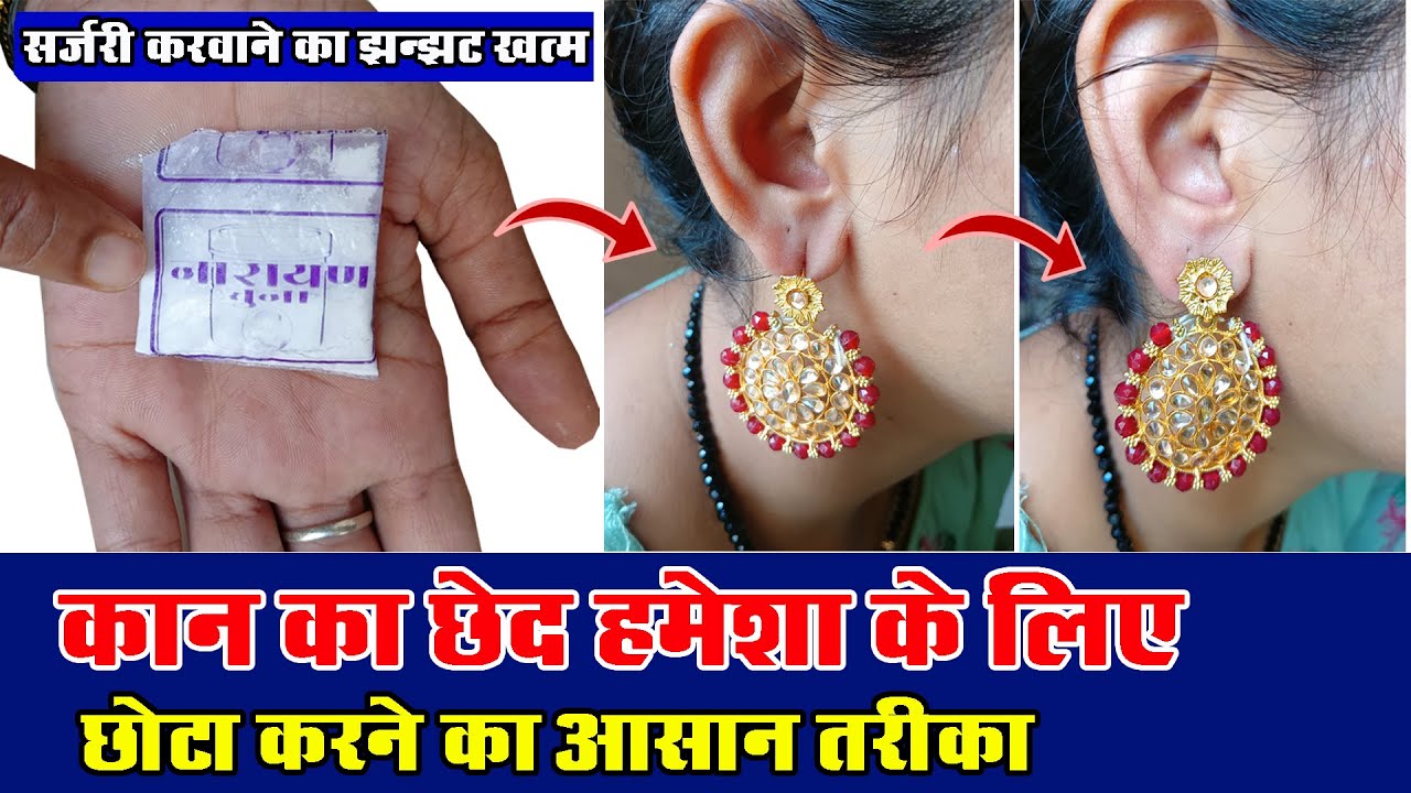 कान का छेद बड़ा है तो घबराएं नहीं इस उपाय से छोटा करें Ear Hole