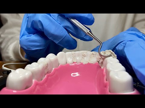 【ASMR】歯石取りロールプレイ｜歯医者さんのクリーニング音でリラックス🦷✨【音フェチ】