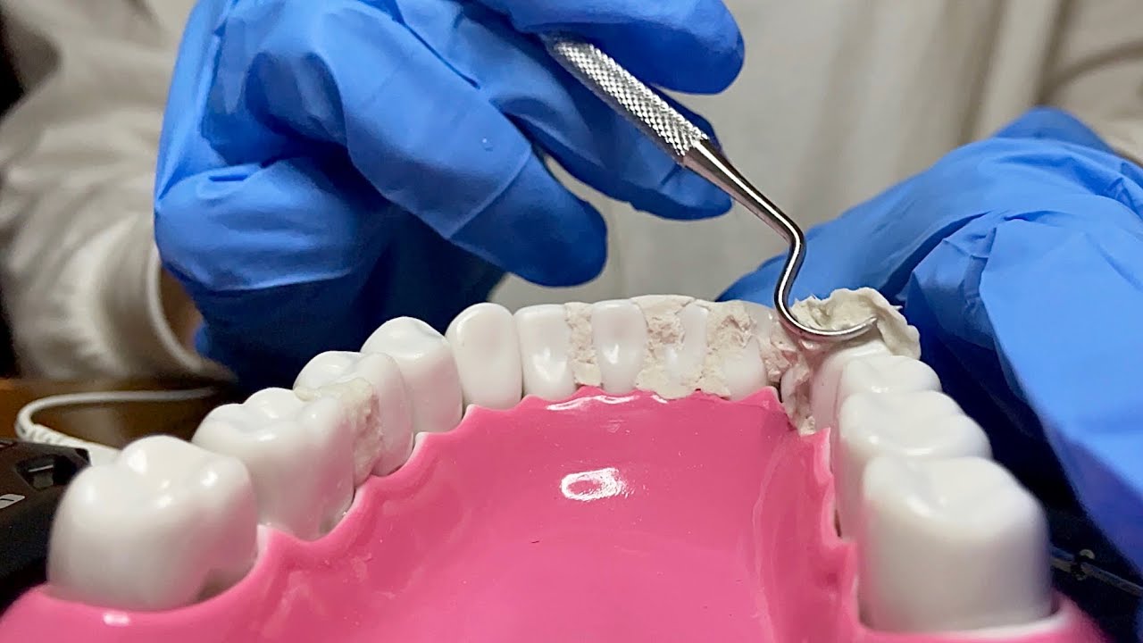 【ASMR】歯石取りロールプレイ｜歯医者さんのクリーニング音でリラックス🦷✨【音フェチ】