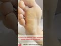 Feet Therapy 2021 #06