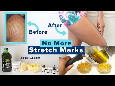 How To Make A STRETCH MARKS REMOVAL SKINCARE CREAM + SCRUB + BODY OIL | Affordable HOME REMEDIES