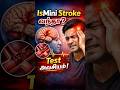 Mini Strokeக்கு பிறகு என்ன Test? Carotid Scan Explained