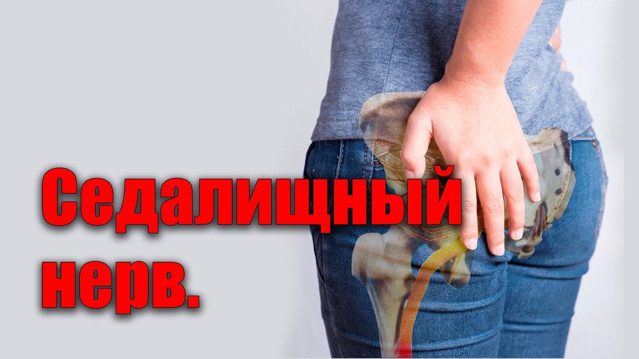 Разблокировать седалищный нерв без боли.