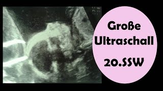 Große Ultraschall Untersuchung | 20. SSW | Ultraschall Schwangerschaft | Kindsbewegungen