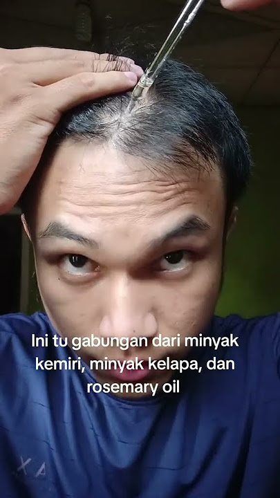 Rosemary oil emang bisa menumbuhkan rambut? #rosemaryoil
