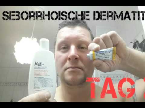 Video: Bestes Shampoo Für Seborrhoische Dermatitis: Natürlich, Medizinisch Und M