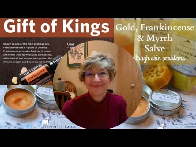 Health benefits of gold, frankincense, and myrrh