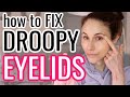 How to FIX DROOPY HOODED EYELIDS| Dr Dray