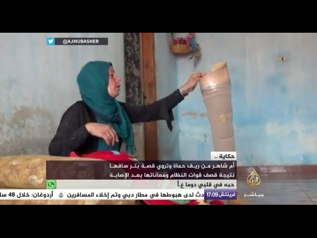 حكاية - أم شاهر من حماة فقدت ساقها بسبب قصف قوات النظام السوري