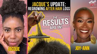 The Root Of Jacque s Thinning Hair What Black Women Need To Know About Healthy Hair Maintenance