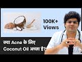 क्या Acne के लिए Coconut Oil अच्छा है? | Is Coconut Oil Good For Acne? | ClearSkin, Pune