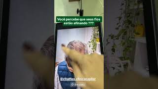 Quando ainda existe fio fino, existe chance de recuperar volume capilar? Veja na tricoscopia