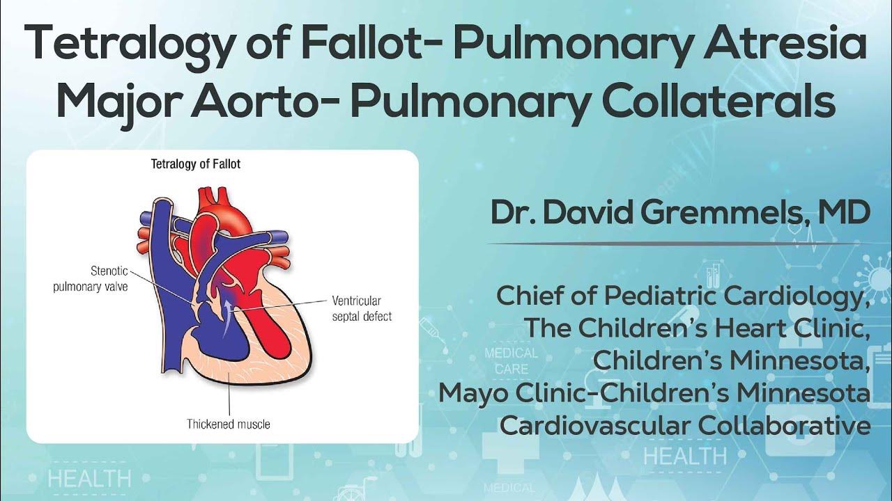 tetralogy-of-fallot-pulmonary-atresia-major-aorto-pulmonary