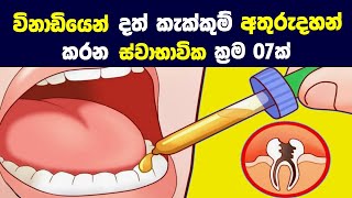 වනඩයන දත කකකම අතරදහන කරන සවභවක කරම 07ක 07 Home Remedies For Toothache