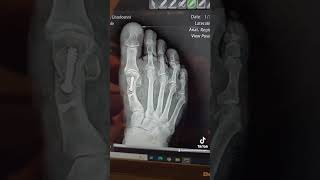 The Impossible Is Possible