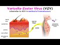 Chickenpox and shingles varicellazoster virus