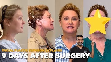 9 Days After Facelift, She Looks Like This