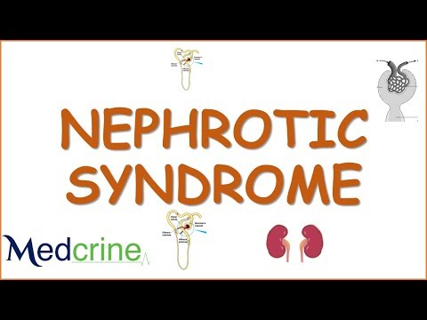 Video: Nephrotic Syndrome - Diagnosis, Symptoms, Treatment