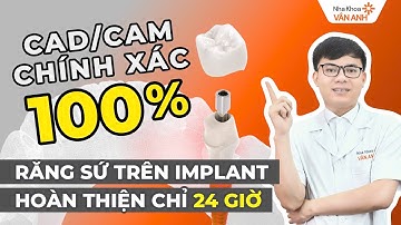 Chế Tác Răng Sứ Implant Bằng Công Nghệ CAD/CAM – Đừng Để Răng Sứ Cộm Cấn Mới Lo Làm Lại!