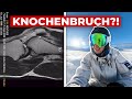 UNNÖTIGE SKI-VERLETZUNG?! Ich habe wieder mal VERK*CKT...