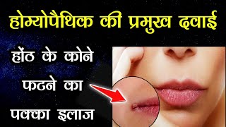 होठ के कोने फटने का इलाज | Cracked lips Treatment | crack lip | Best Remedy for LIPS | Dr Tarun screenshot 3