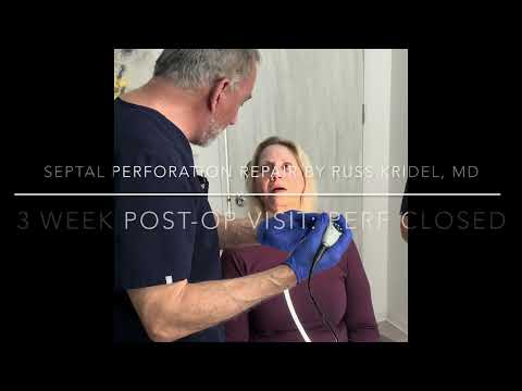 Septal Perforation Repair 3 Week Postoperative