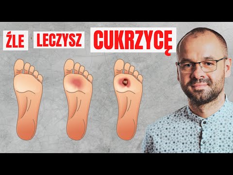 Wideo: 4 sposoby na uzyskanie bezpłatnych materiałów na cukrzycę