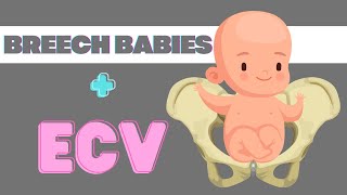 Is Your Baby Breech? Heres Some Options
