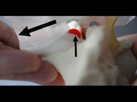 Double Spondy Model - Demonstrating both a Lytic and Non-Lytic Pars human resources jobs