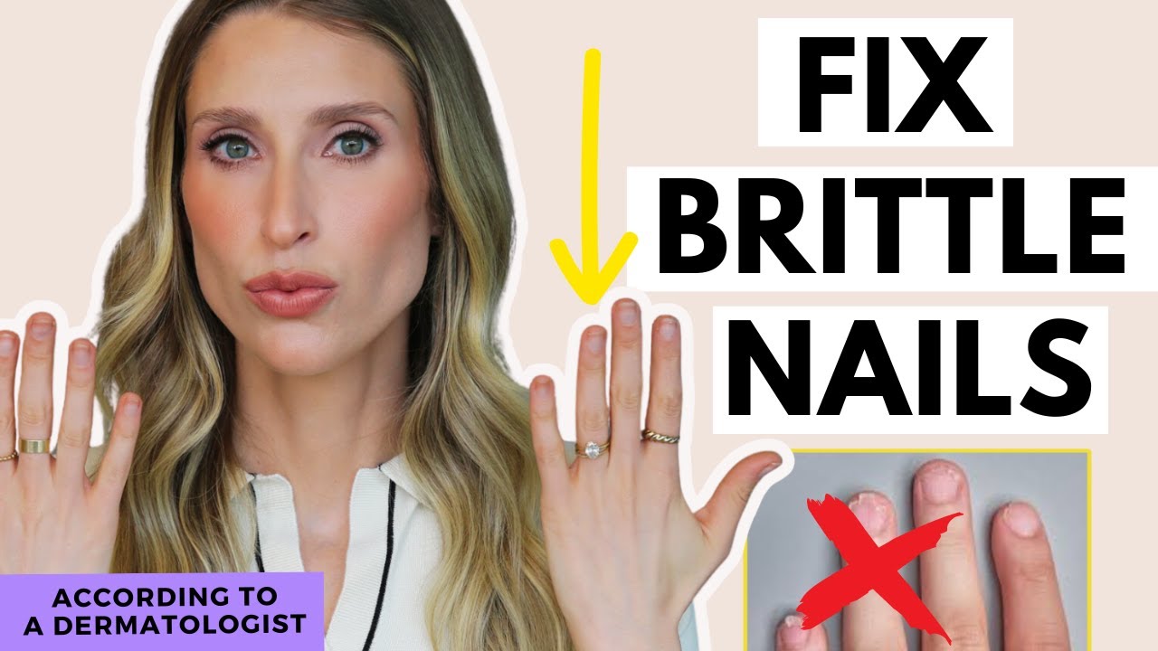 Fix Brittle Nails | How to Naturally Grow Stronger Nails | Dr. Sam Ellis