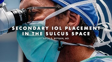 Secondary IOL Placement in the Sulcus Space by Erick D. Bothun, MD | Preview