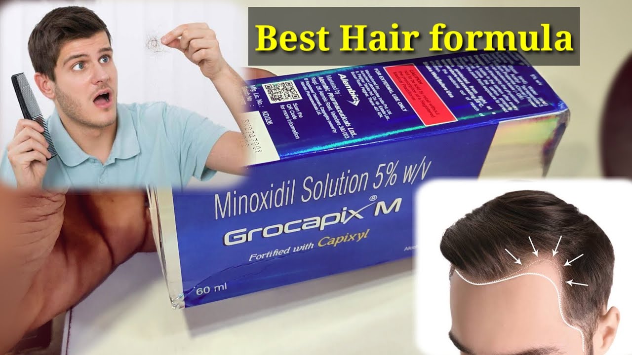grocapix-m-solution-promote-hair-growth-in-men-minoxidil-solution