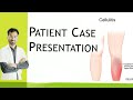 Cellulitis: Symptoms, Causes & Treatment | Real Case Explained