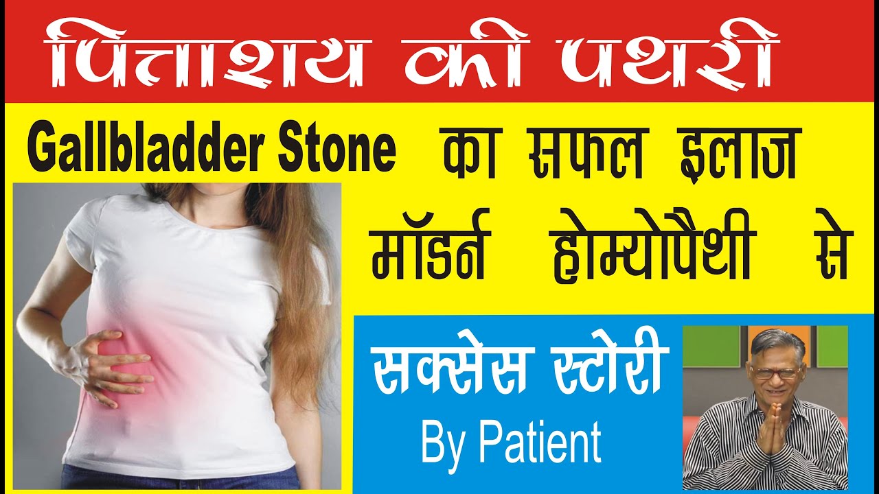 Gallbladder Stone Homeopathic Treatment Gallbladder Stone in Hindi
