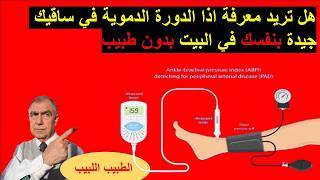 نعم تستطيع وحدك ان تعرف اذا الدورة الدموية في ساقيك جيدة ام لا بدون طبيب