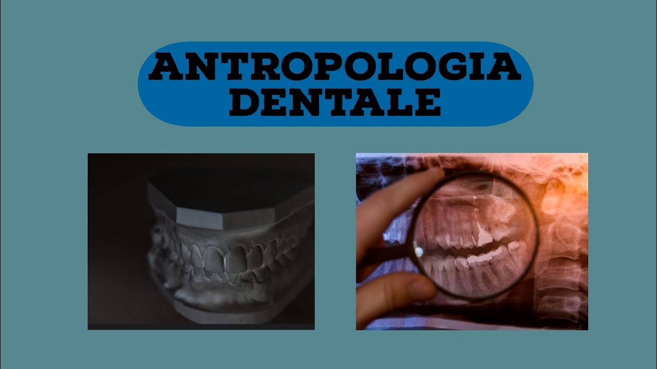 Matrici Dentali A Forma D'onda Matrici Metalliche Dentali Per - Foto 8