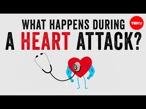 Video: Extensive Heart Attack: What Is It, Consequences, Symptoms, Causes