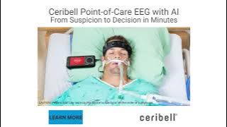Ceribell Point-of-Care EEG with AI
