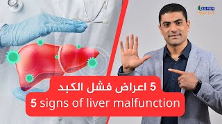 5 اعراض فشل الكبد ||| signs of liver malfunction
