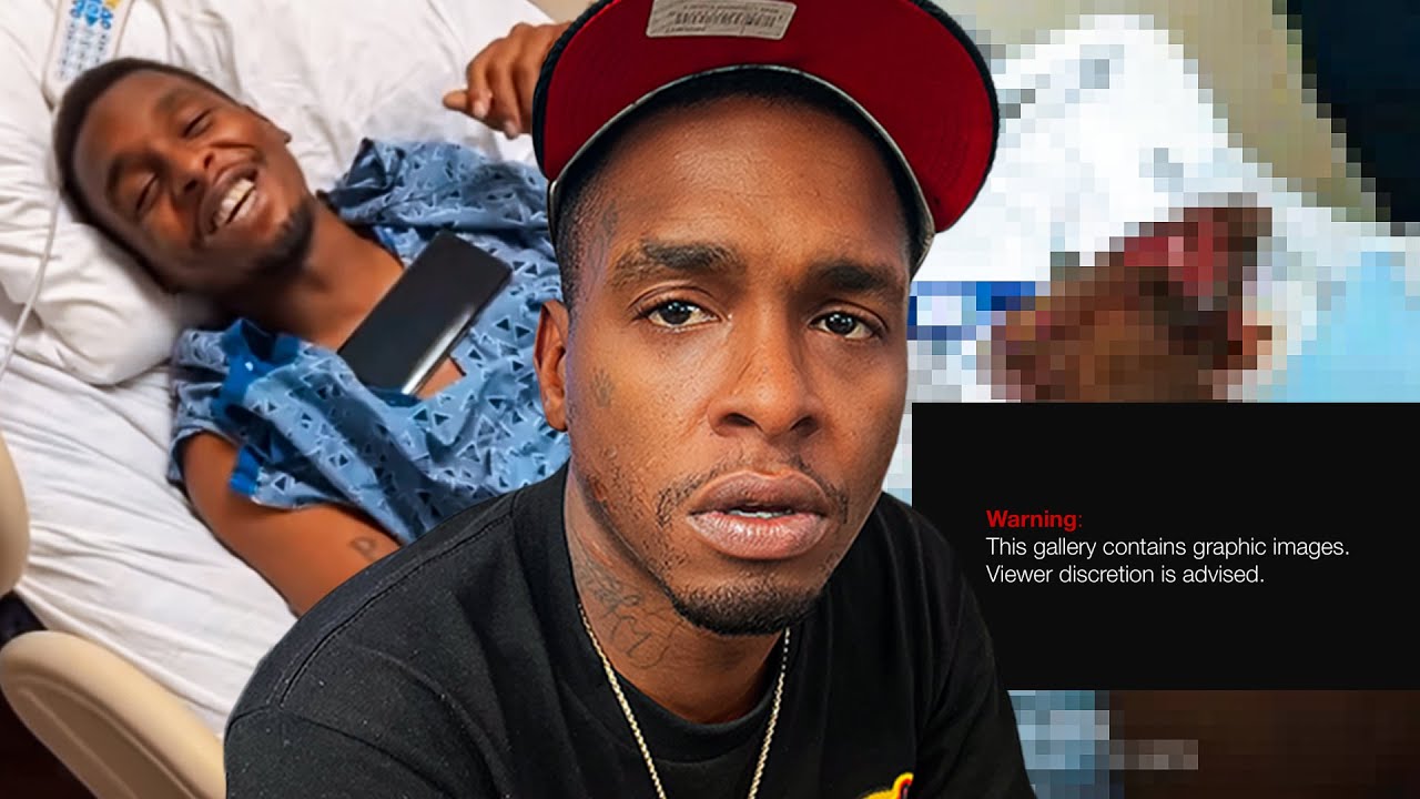 Smac Rapper Smac Goes Into Detail The Injuries He Received From Bike Crash - YouTube