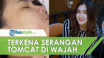 Nella Kharisma Kena Serangan Tomcat saat Hamil 8 Bulan, Dory Harsa Prihatin dengan Kondisi Istrinya