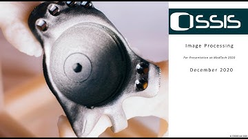 Ossis: Image processing for custom bone implant surgery