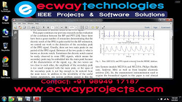 Secondary Peak Detection of PPG Signal for Continuous Cuffless Arterial Blood Pressure Measurement