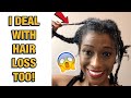 MY HAIR LOSS STORY! BEFORE YOU GET SISTERLOCKS!