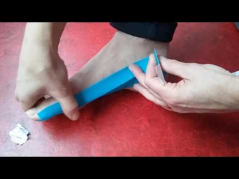 Video: Hoe een grote teenbult te behandelen?