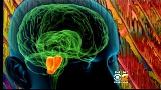 Dr. Max Gomez: Easing Symptoms Of Parkinson's
