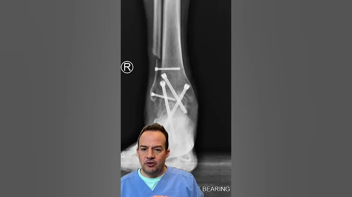 AMAZING HE CAN STILL WALK! 😱#shorts