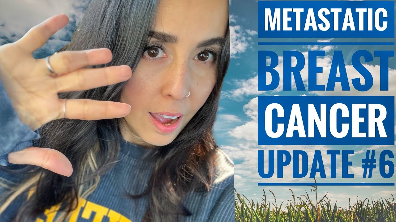 Living with Metastatic Breast Cancer Update #6 - YouTube