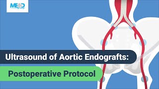 Ultrasound of Aortic Endografts: Postoperative Protocol
