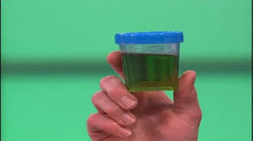 O que significa quando a urina está verde?